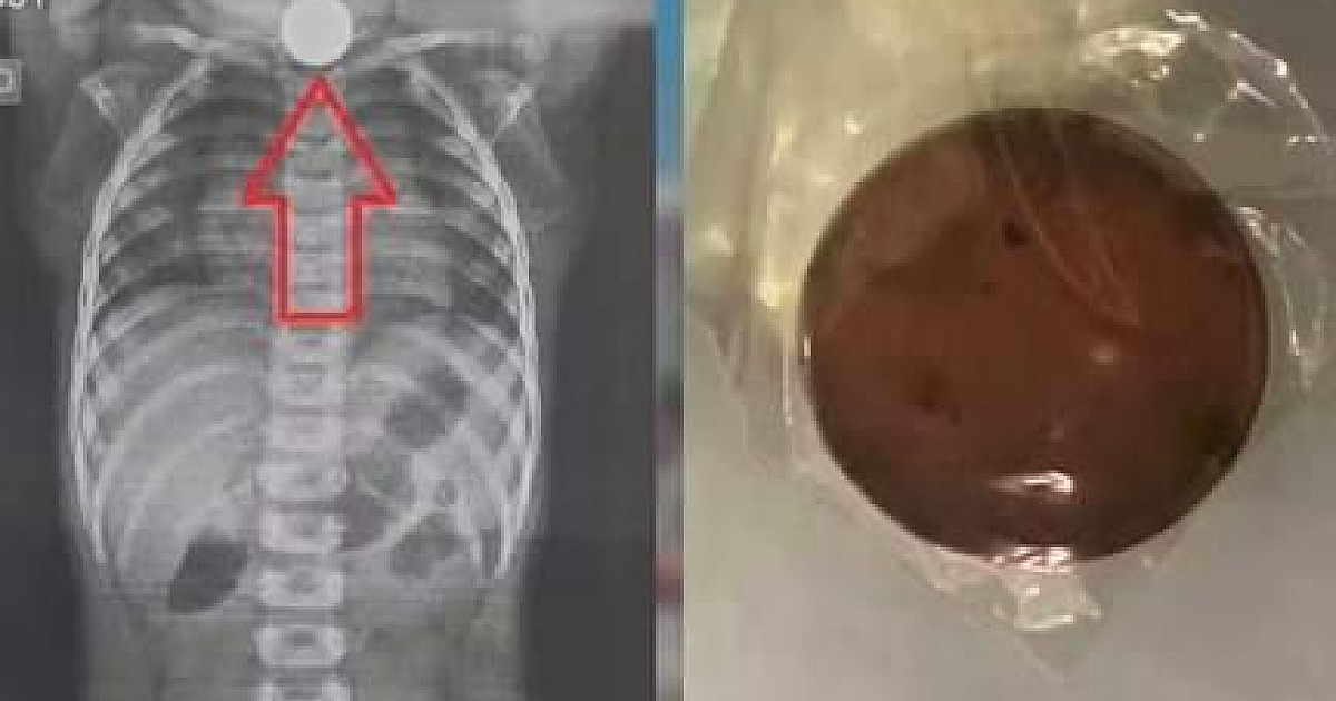 Ilhabela disponibiliza 1 mil doses de vacina contra a gripe no “Dia D”
